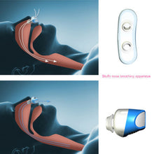 Anti Snore Ventilation Nose